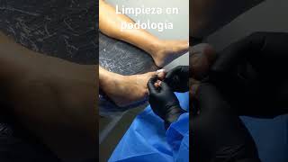 podologia podólogo uñas hongosenlasuñas limpieza [upl. by Swithin]