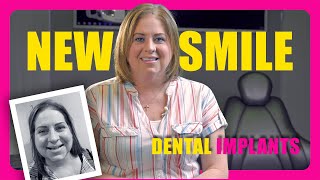 Before And After Dental Implants  Why I Love Them [upl. by Enyledam]