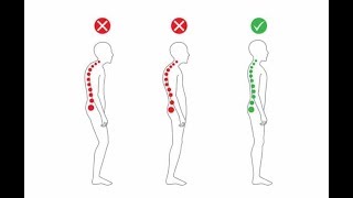 Neutral Spine Test  Check Your Posture for Signs of Lordosis [upl. by Nojed]