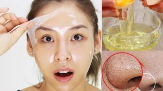 Egg White Face Mask  Diy Face Mask For Loose Skin Skin Tightening amp Open Pores 🌿 [upl. by Hagi]