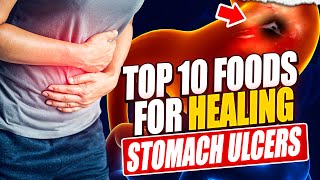 Top 10 Foods to Heal Your Stomach Ulcer Naturally [upl. by Eberly514]