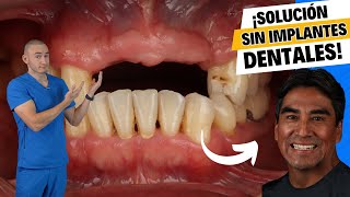 ¿Te faltan dientes y no quieres implantes Solución asequible  Dentadura removible [upl. by Ailey]