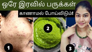 How To Remove Pimples OvernightBeauty tips in tamil [upl. by Eixel]