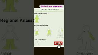 Types of anaesthesia medicostudent anaesthesia new viral shorts [upl. by Kozloski]