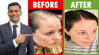 3 Home Remedies To Prevent Hair loss And Regrow Your Hair [upl. by Tolkan]