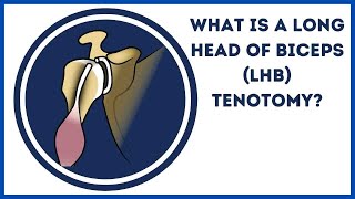 What is a Long Head of Biceps LHB Tenotomy [upl. by Callan]