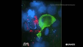 How HIV kills so many CD4 T cells  Infectious diseases  NCLEXRN  Khan Academy [upl. by Gentry]