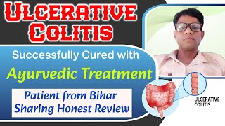 Ulcerative Colitis Ayurvedic Treatment Successfully Cured Patient From Bihar Sharing Honest Review [upl. by Tilda]