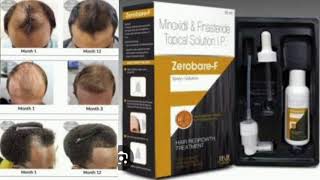 Zerobare F Topical Solution Minoxidil amp Finasteride Topical Solution [upl. by Introc]