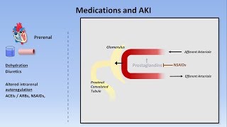 Acute Kidney Injury Part 13  Definitions and Etiologies [upl. by Neros]