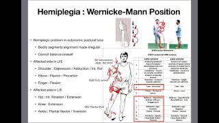 Post Stroke Physiotherapy Interventions [upl. by Naivatco]