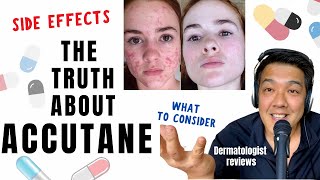 ACCUTANE  Dermatologist Review Unbiased [upl. by Ybrik]