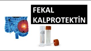 FEKAL KALPROTEKTİN TESTİ NEDİR [upl. by Secnirp]