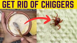 Effortlessly Remove Chiggers from Your Yard amp Prevent Their Bites [upl. by Davena125]