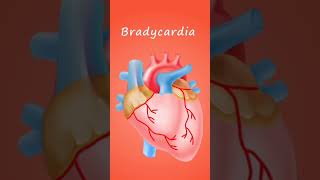 bradycardia biology science [upl. by Alister]