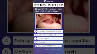 NEET MDS  INICET MDS  PSC  BDS  Most Important Questions neetmds2025 mdsprep [upl. by Eatnhoj]