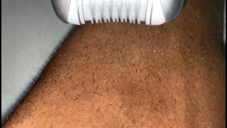 EPILATING THICK LEG HAIR [upl. by Conias]