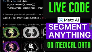 RUNNING SEGMENT ANYTHING MODEL FROM META ON MEDICAL IMAGING DATA  LIVE CODING DEEP LEARNING [upl. by Clare]