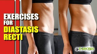 Exercises for Diastasis Recti [upl. by Uyr]