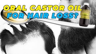 Oral Castor Oil For Hair Loss Prevention [upl. by Duhl958]