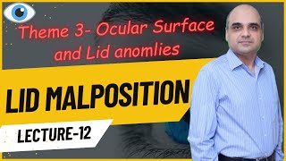 Lid Malpositions Lecture 12 [upl. by Stucker]