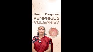 How to Diagnose Pemphigus Vulgaris [upl. by Akienom]