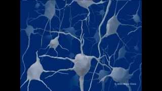 Mayo Clinic Medical Animation  Lewy Body Dementia [upl. by Karlene]