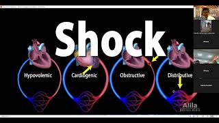 Cardiogenic shock AMC [upl. by Yelats]