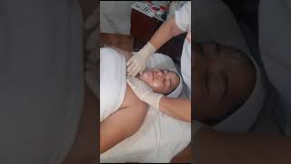 limpieza facial con microdermoabrasion [upl. by Aselehc613]