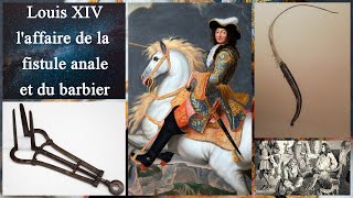 Louis XIV  laffaire de la fistule et du barbier [upl. by Delphina346]