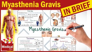 Myasthenia Gravis Symptoms Causes Treatment Pathophysiology  What is Myasthenia Gravis [upl. by Plusch703]