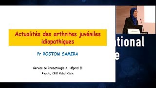 Arthrite Juvénile Idiopathique en 2017 [upl. by Liman]