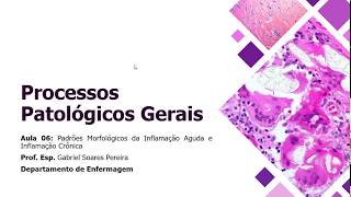 Aula 06  Padrões Morfológicos da Inflamação Aguda e Inflamação Crônica [upl. by Hamirak]