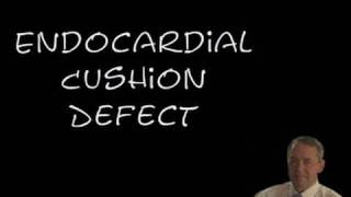 Endocardial Cushion Defect [upl. by Inacana532]