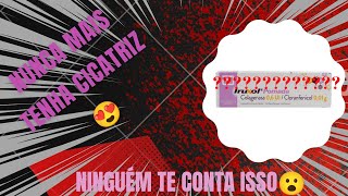 VLOG POMADA IRUXOL  colagenase e cloranfenicol [upl. by Levi]