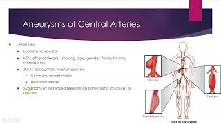 Peripheral Vascular Disease [upl. by Frodine]