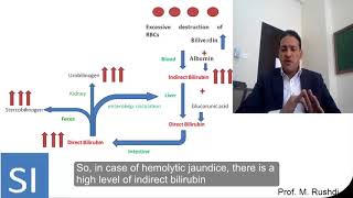 Laboratory diagnosis of jaundice [upl. by Mir]