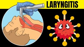 Laryngitis Acute amp Chronic  Causes Signs amp Symptoms Diagnosis And Treatment [upl. by Eneri825]