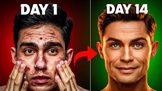 How To Get Glass Skin In 14 Days scientifically proven [upl. by Galina]