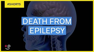 Can You Die From Epilepsy Shorts [upl. by Nollie394]