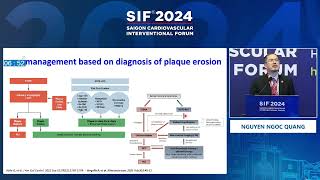 SIF 2024  Main Arena  Session 2  STEMI amp ACS [upl. by Rasla]