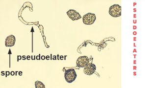 Pseudoelaters plants hornwort anthoceros bryophytes spore scattering dispersal cell sterile [upl. by Trstram]