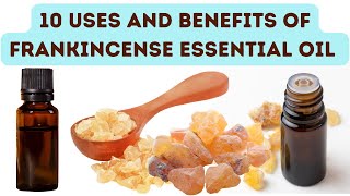 10 Uses and Benefits of Frankincense Essential Oil [upl. by Kendry]