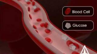 Diabetes Education  3D Medical Animation [upl. by Halpern]