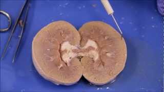 NAU Bio 202 Lab 7  Sheep Kidney Dissection [upl. by Hannibal401]