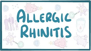 Allergic Rhinitis  causes symptoms diagnosis treatment pathology [upl. by Altheta138]