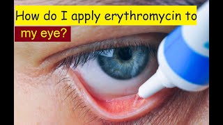 How do I apply erythromycin to my eye [upl. by Hsitirb541]