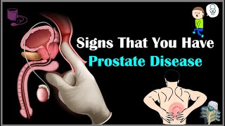 Prostatic Adenocarcinoma  Histopathology [upl. by Llerdnad]