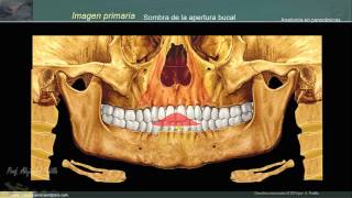 Estructuras anatómicas en la radiografía panorámica II [upl. by Mata353]