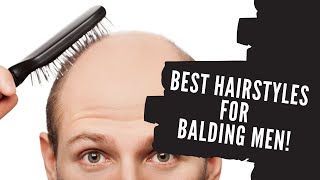 Best Hairstyles for Balding Men [upl. by Ailin]